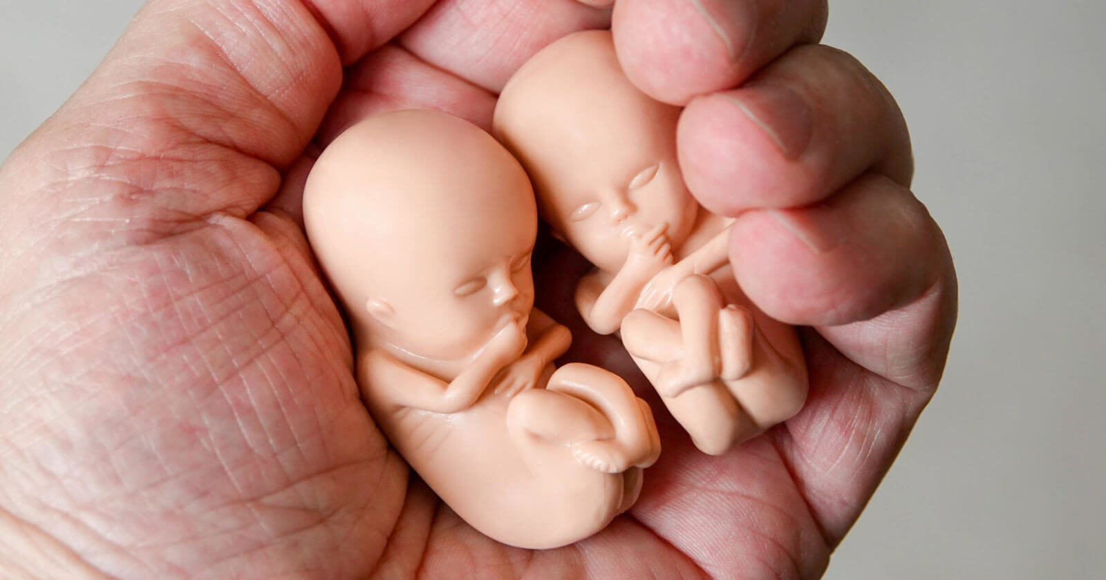 Fact Sheet: Reasons for Abortion. 95.9% of Child Murder is Elective