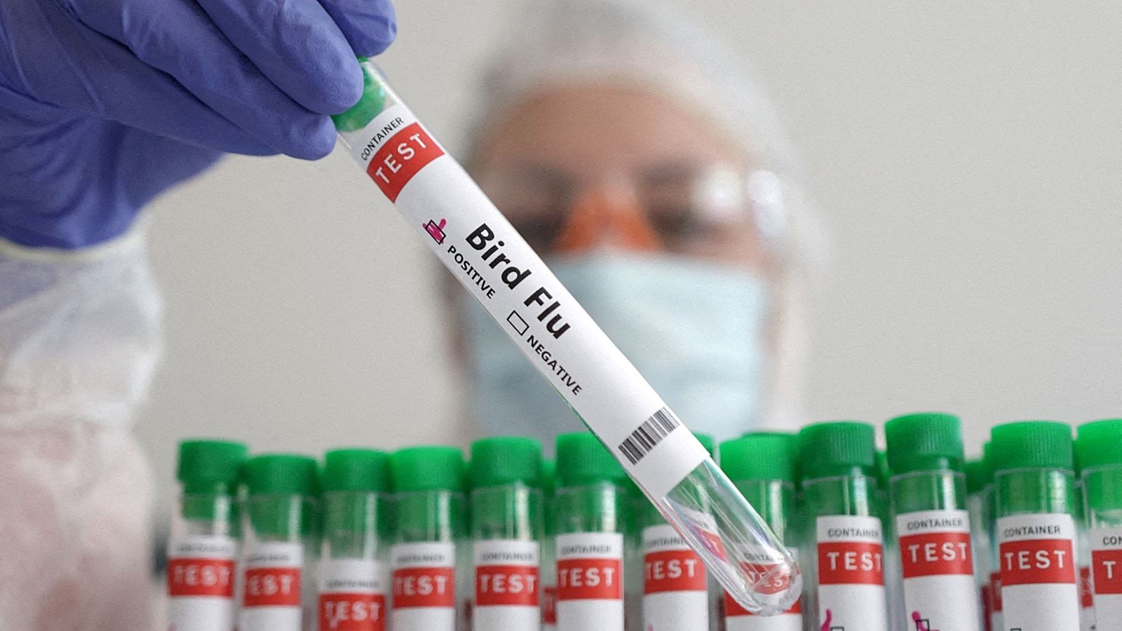 The CDC Reports the First Bird Flu Case with Mutations and Warns we could be Facing “Another Scamdemic”
